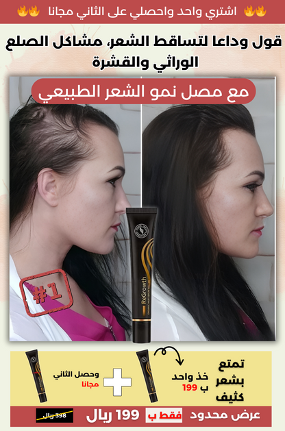 رولر ™Regrowth العلاج الطبي الفعال لتساقط الشعر