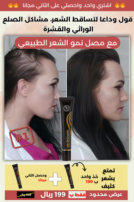 رولر ™Regrowth العلاج الطبي الفعال لتساقط الشعر