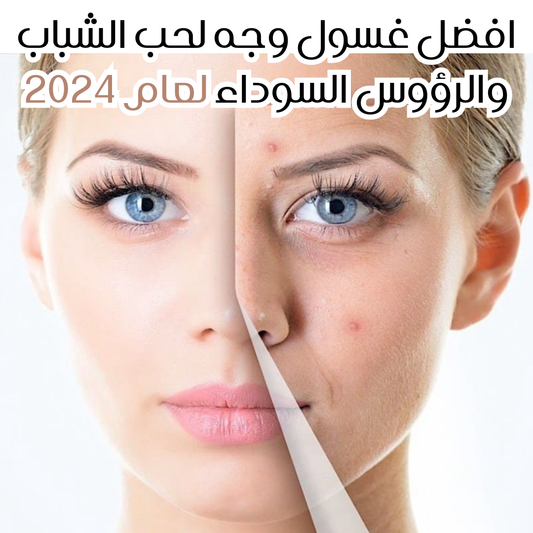 افضل غسول وجه لحب الشباب والرؤوس السوداء لعام 2024